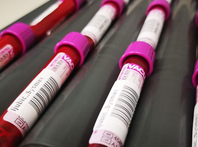 Poliklinika Bonifarm - Laboratorij