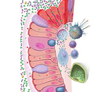 Sindrom propusnog crijeva - Leaky Gut Syndrome